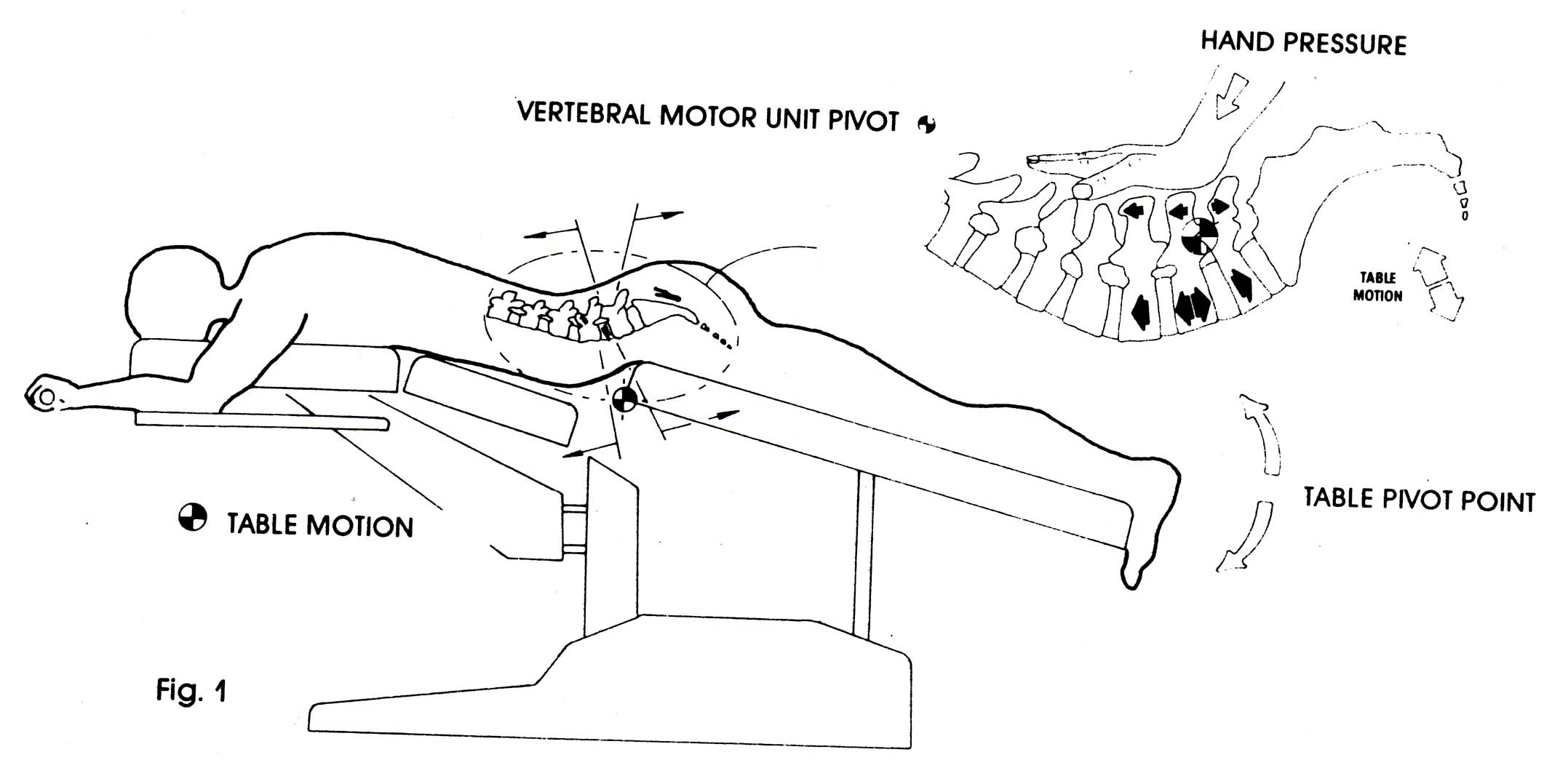 Flexion Distraction Therapy 